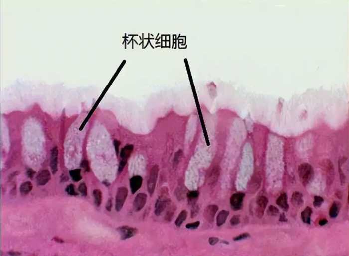 嗓子里总有痰，吐也吐不完？教你几点，切断这“生痰之源”